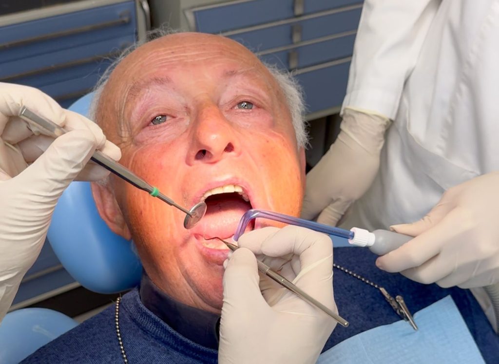 impianto dentale